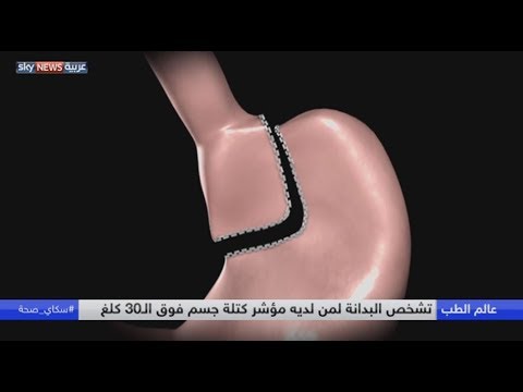شاهد البدانة مرتبطة بالسكري والقلب والسرطان