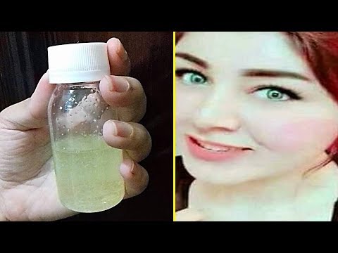 شاهد طريقة سهلة للتخلص من اسمرار الوجه والبقع الغامقة