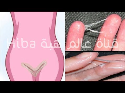تخلصي من الافرازات المهبلية الغير طبيعية والرائحة الكريهة والحكة