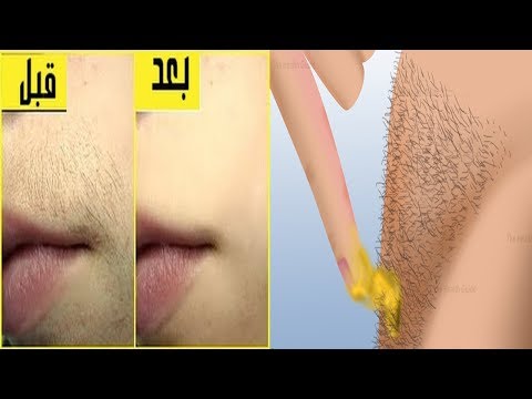 شاهد طريقة مذهلة لإزالة شعر المناطق الحساسة دون ألم