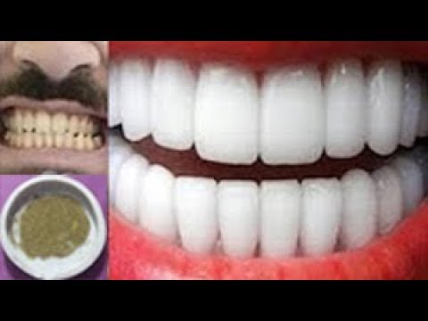 تبييض الأسنان بخلطة طبيعية وصحية