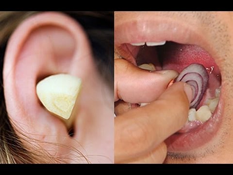 5 أمراض يمكنك علاجها باستخدام البصل