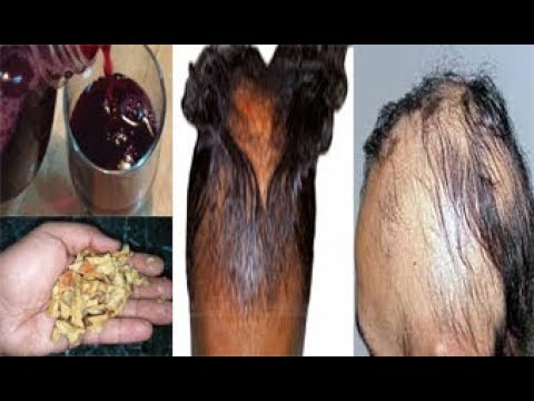 شاهد قشور الرمان لانبات الشعر وتكثيفة وعلاج الصلع والشيب