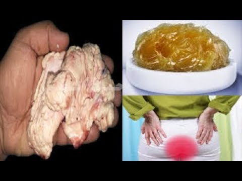 بالفيديو  اكتشاف دهان من الحيوان لعلاج البواسير نهائيًا