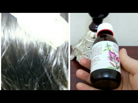 وصفة مذهلة للقضاء على الشعر الأبيض بشكل نهائي