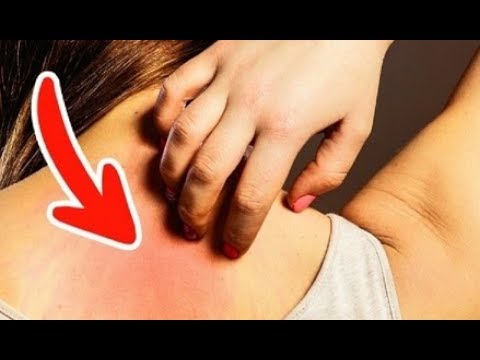 شاهد 7 علامات مبكرة تشير إلى مرض السرطان يتجاهلها الكثيرون