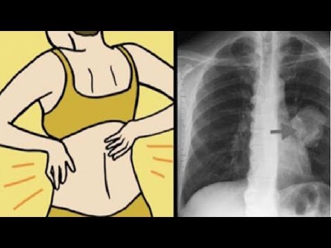 شاهد متى تذهب فورًا إلى الطبيب 