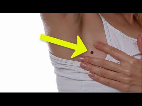 بالفيديو علامات تنذر بقرب إصابتك بسرطان الثدي