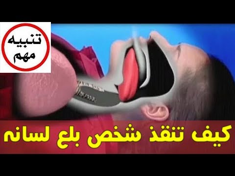 شاهد كيفية إنقاذ شخص بلع لسانه