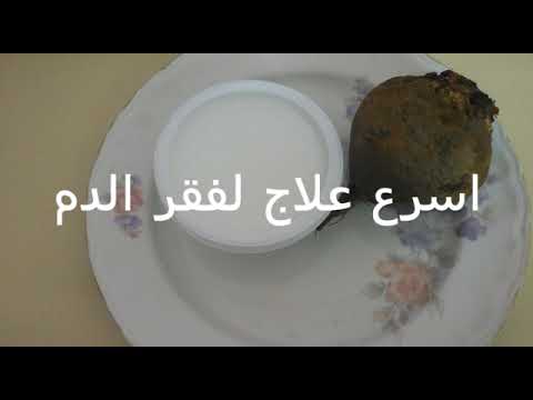 بالفيديو علاج الأنيميا في 3 أيام 