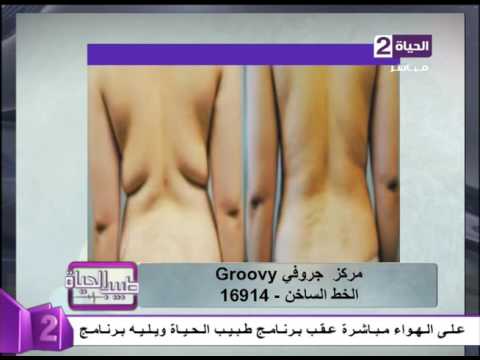 بالفيديو نتائج مبهرة بعد إستخدام الفيزر للتنحيف