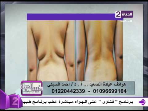 شاهد نتائج مبهرة بعد التخلص من الدهون بالفيزر