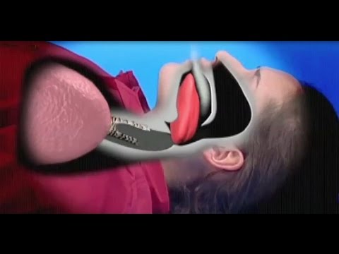 كيفية إنقاذ شخص بلع لسانه بشكل مفاجئ