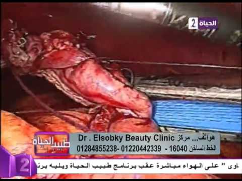 بالفيديو شرح بسيط لعملية تحويل المسار بالمنظار